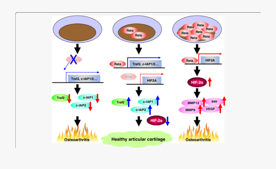 Regulation Of Articular Cartilage By Nf Κb Signalling - Osteoarthritis Molecular Mechanism, Transparent Clipart