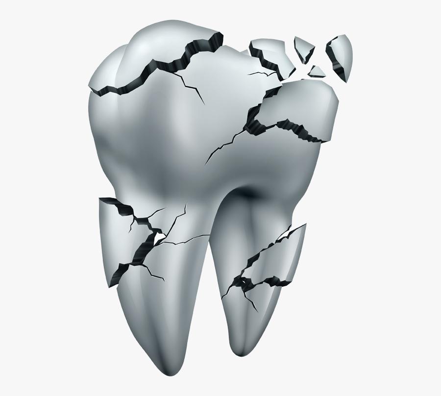 What To Do If You Break A Tooth - Broken Tooth, Transparent Clipart