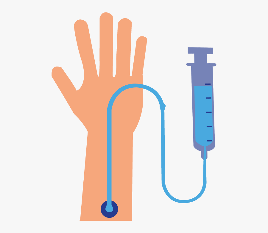 Intravenous Line Graphic In Hand, Transparent Clipart