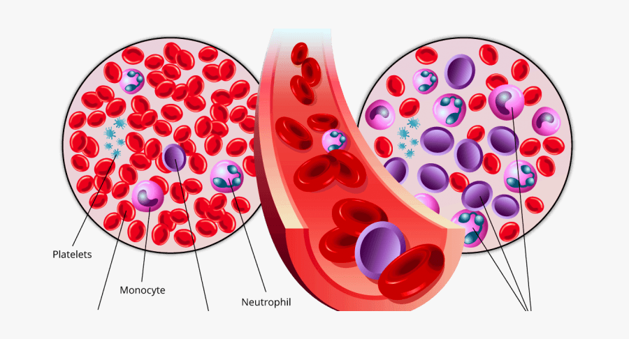 Cell Division Cycle 7 Related Protein Kinase Market - Blood Cancer, Transparent Clipart