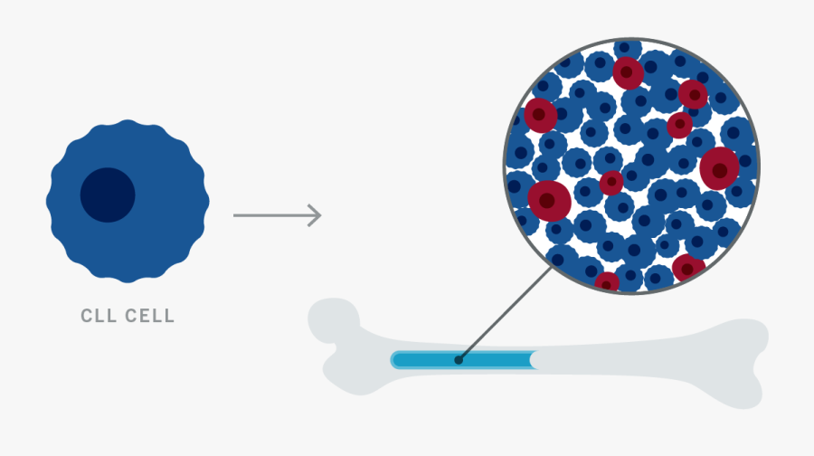 Cll Vs Normal Cell, Transparent Clipart