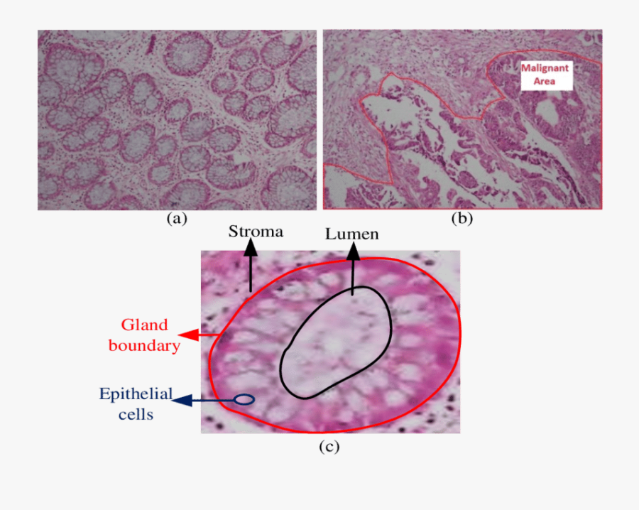 Transparent Microscopes Clipart - Structure Of Colon Tissue, Transparent Clipart