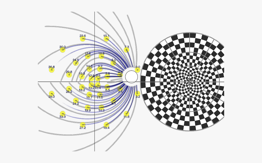 Mfvep In Optic Neuritis, Transparent Clipart