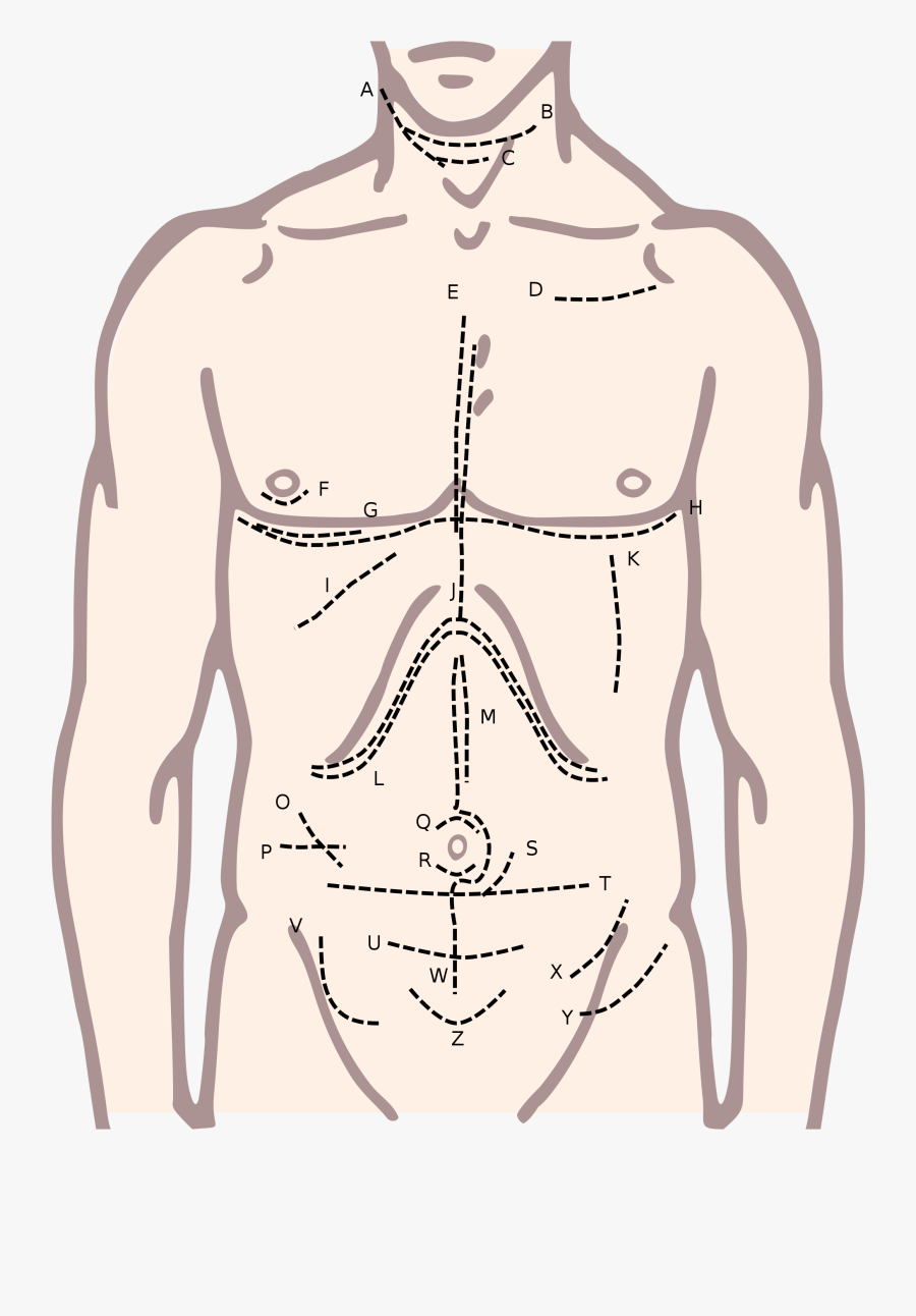 Clip Art Surgical Incision Wikipedia Anatomyedit - Chest Clipart Black And White, Transparent Clipart