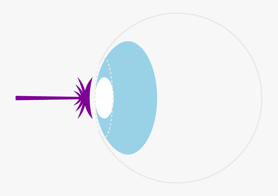 Transparent Laser Eye Surgery Clipart - Circle, Transparent Clipart