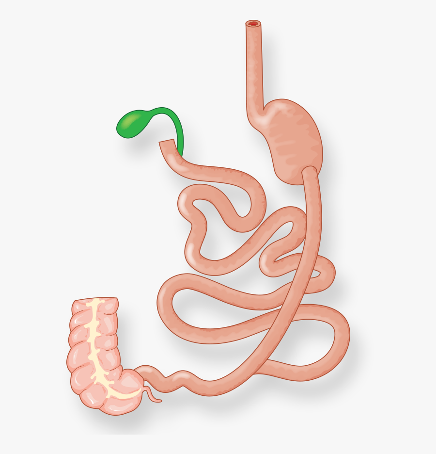 Illustration Of Intestines And Stomach After Duodenal, Transparent Clipart