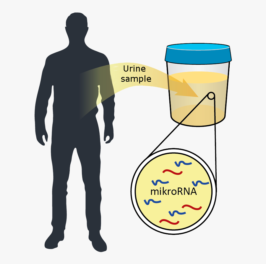 Patient Clipart Hospital Department - Urine Sample Prostate Cancer, Transparent Clipart
