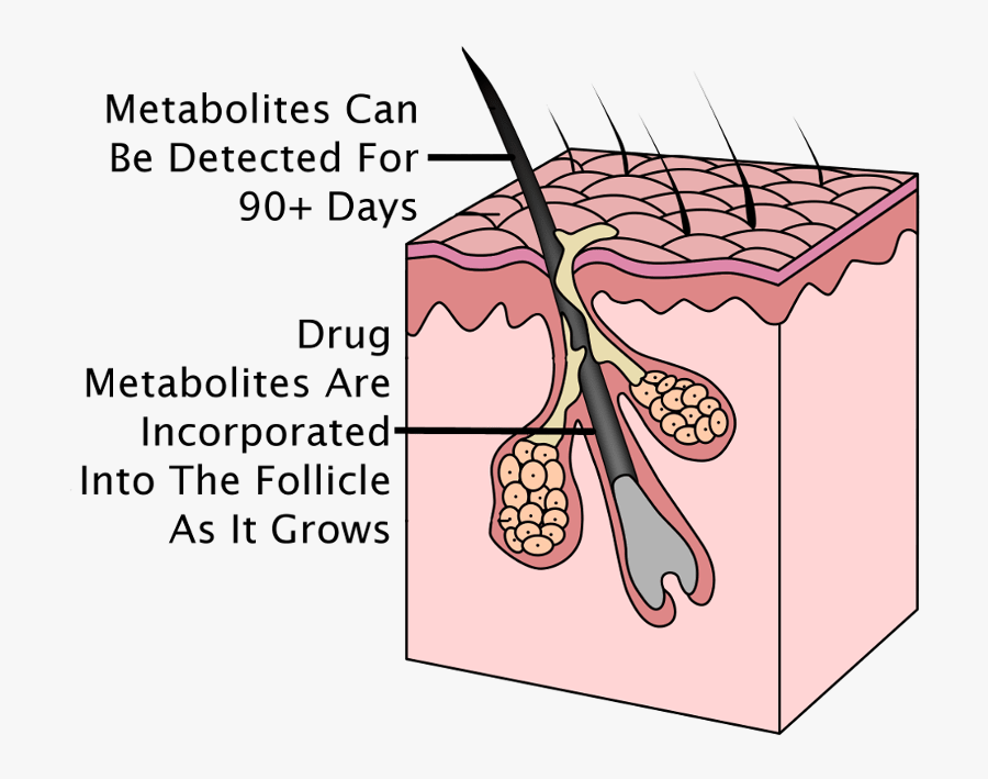 Hair Follicle, Transparent Clipart