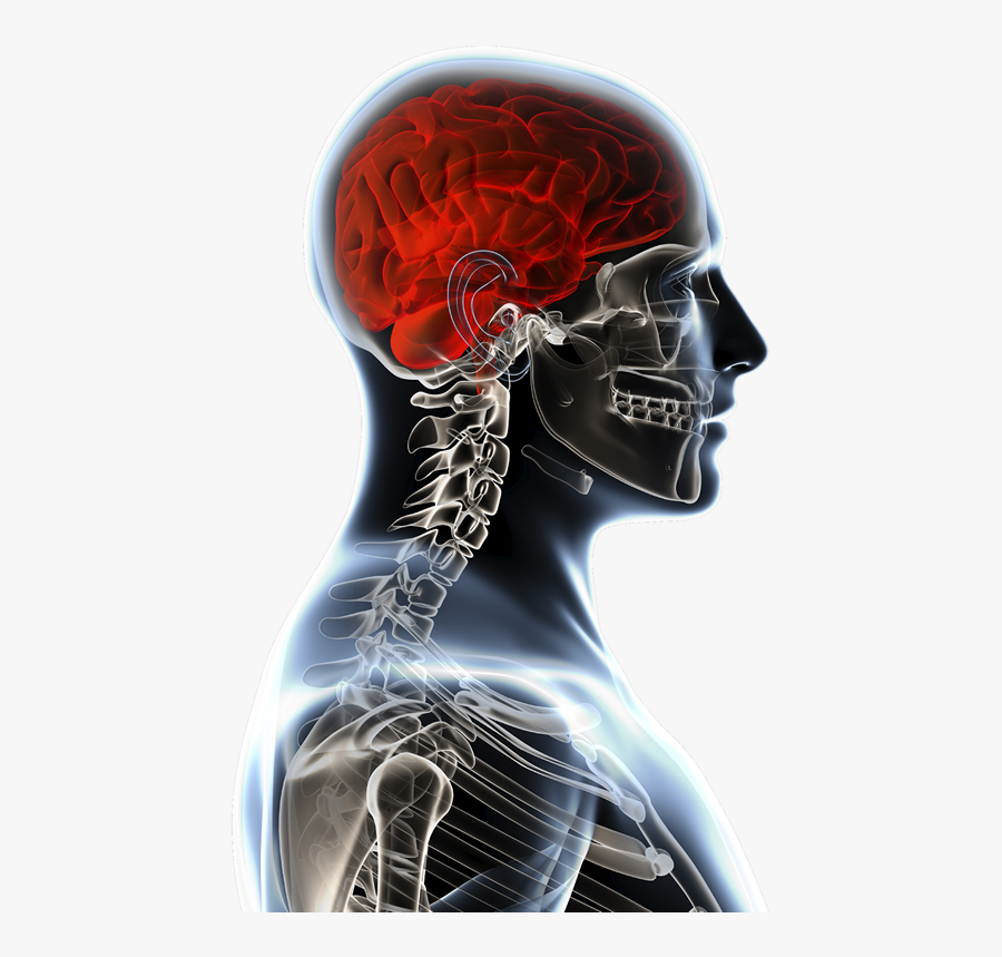 Brain Injury Png - Head Injury Png, Transparent Clipart