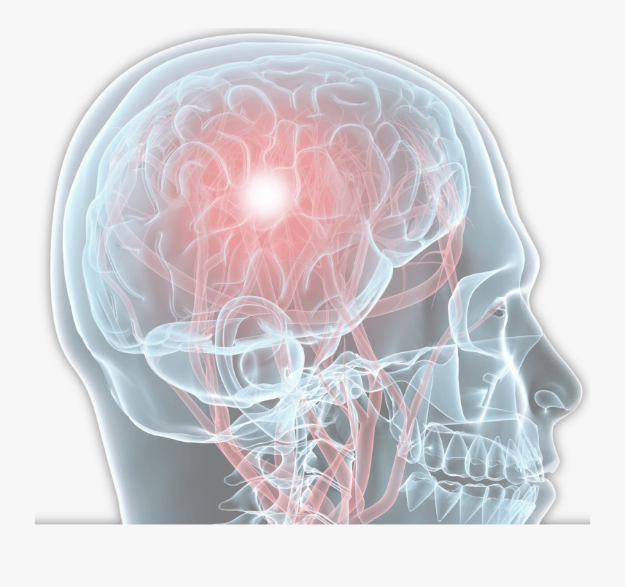 Virginia Beach Brain Injury Attorneys - Brain Injury, Transparent Clipart