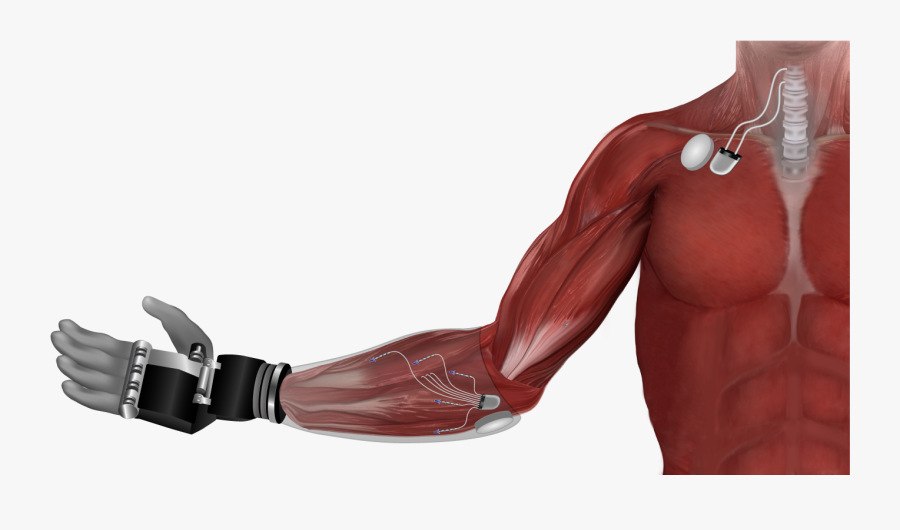 Prosthetics Transparent, Transparent Clipart