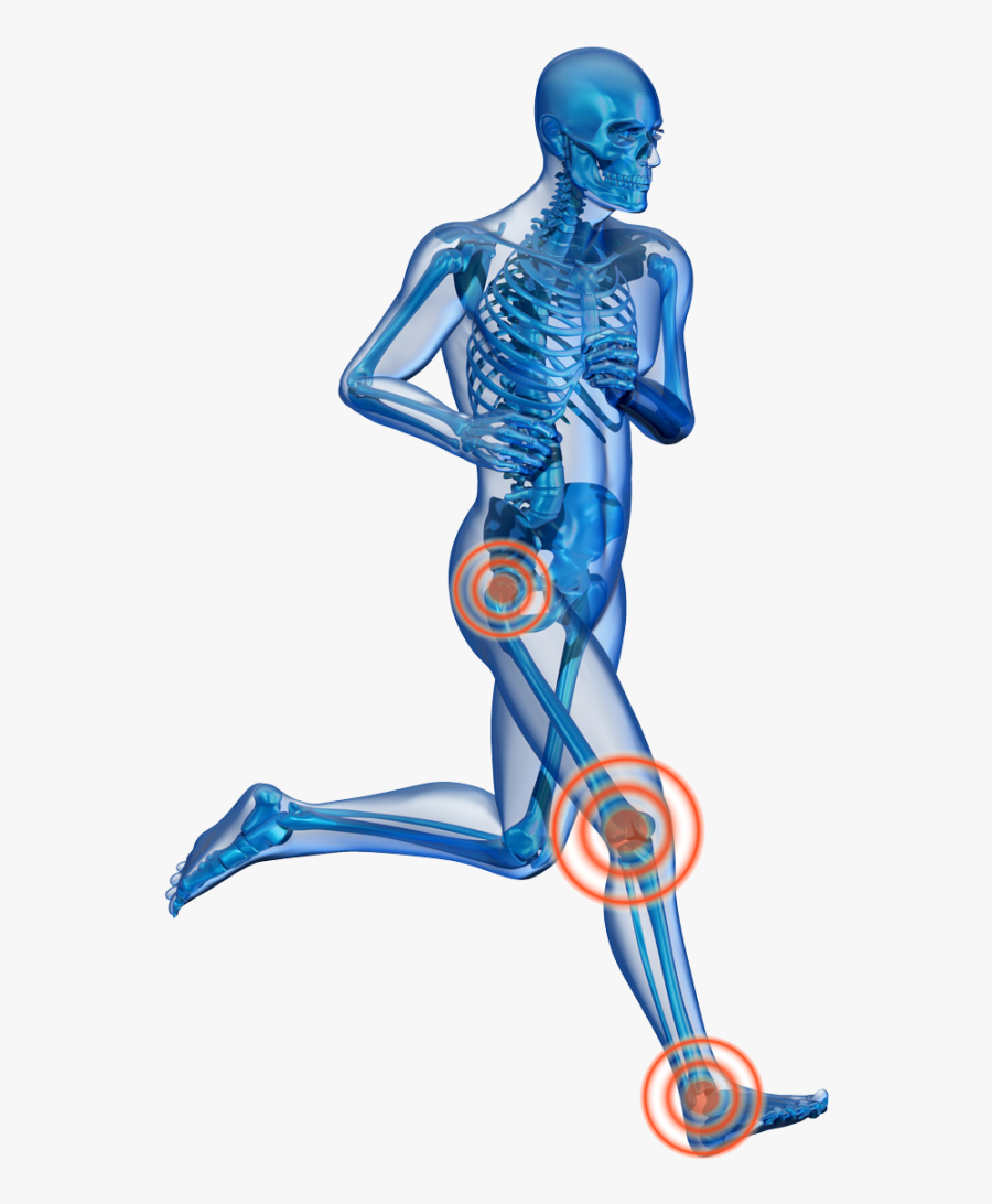 3 Causes Of Knee Pain - Man Running X Ray, Transparent Clipart