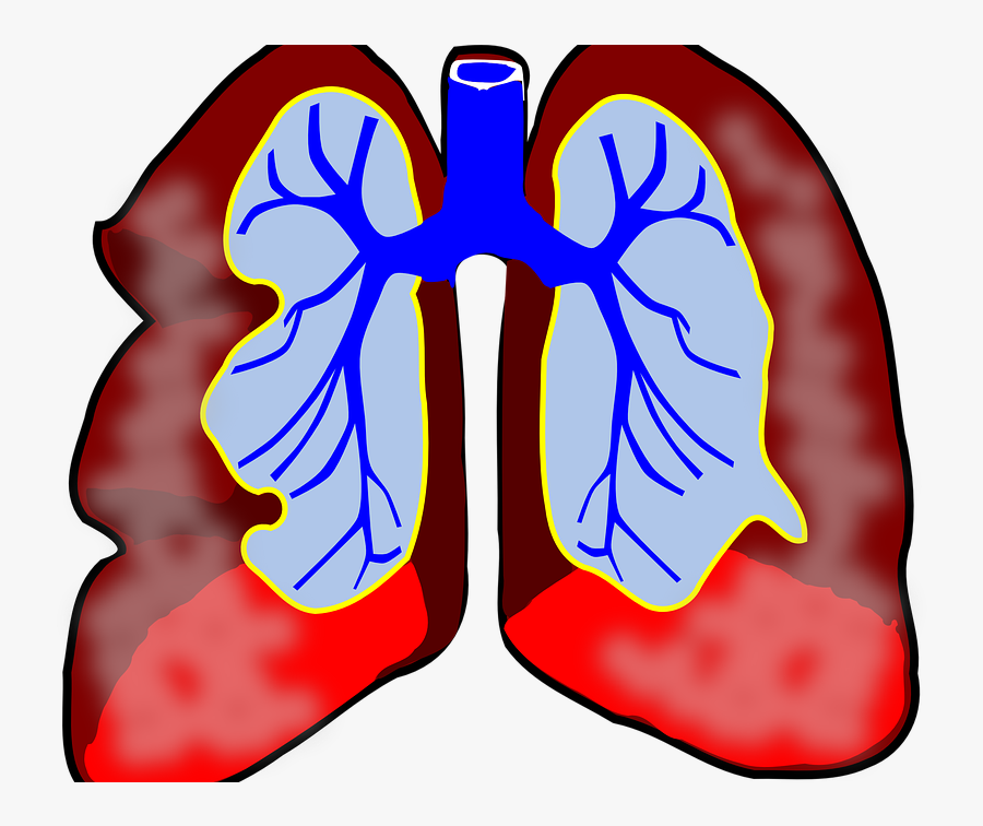 Asthma - Lung With Cancer Clipart, Transparent Clipart