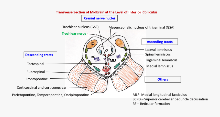 Clip Art Anatomy External And Internal - Midbrain At Level Of Inferior Colliculus, Transparent Clipart