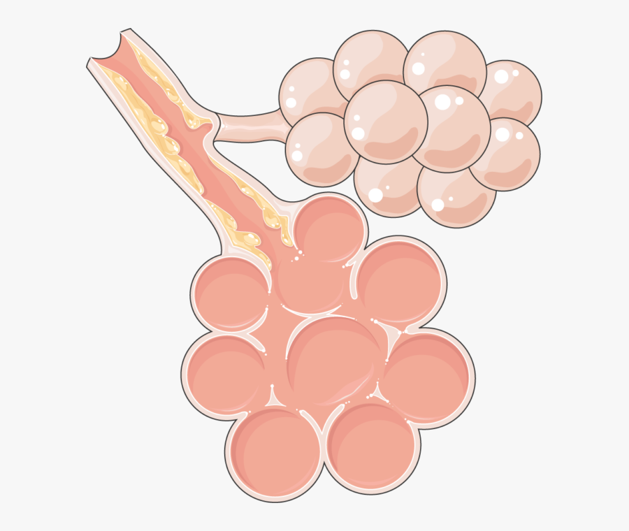 Chronic Bronchitis Png, Transparent Clipart