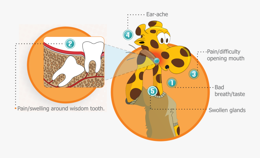 Oral Surgery Make A - Cartoon, Transparent Clipart