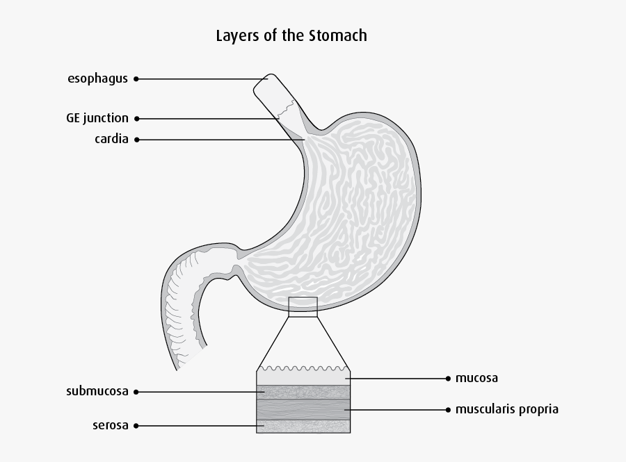 Non Hodgkin S Lymphoma Ribbon Clip Art, Transparent Clipart