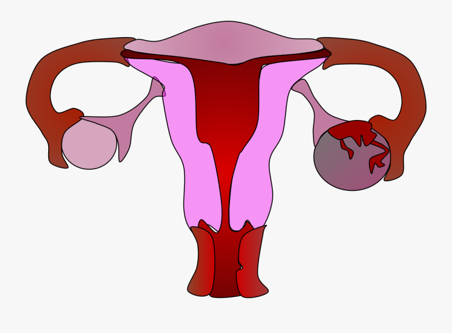 Ovarian Apoplexy, Transparent Clipart