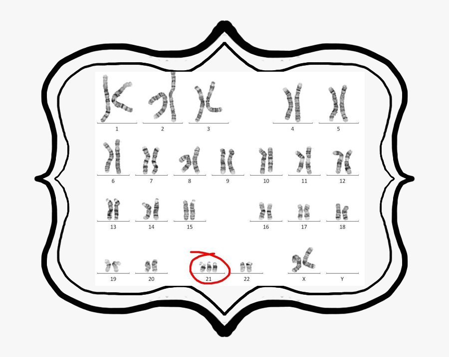 Extra Chromosome Causes Down Syndrome, Transparent Clipart