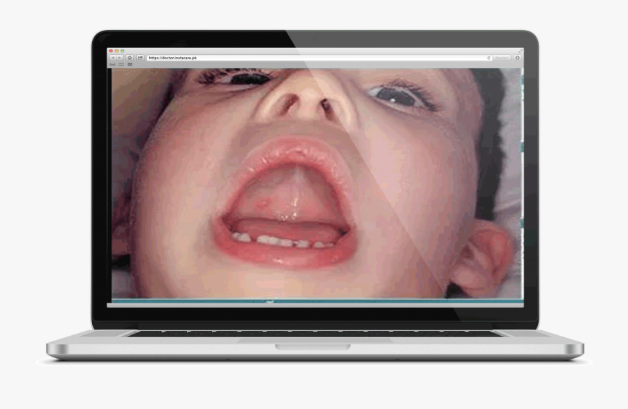 Scope Of Telemedicine - Laptop, Transparent Clipart