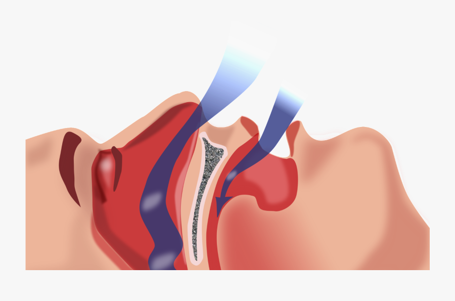 Airways In First Aid, Transparent Clipart