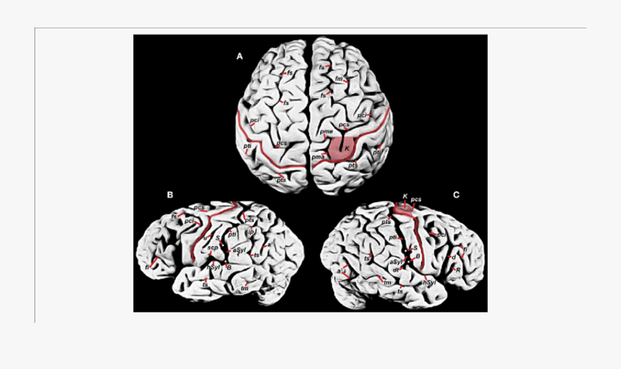 Photographs Of Einstein"s Brain That Were Taken In - Einstein's Brain And Music, Transparent Clipart