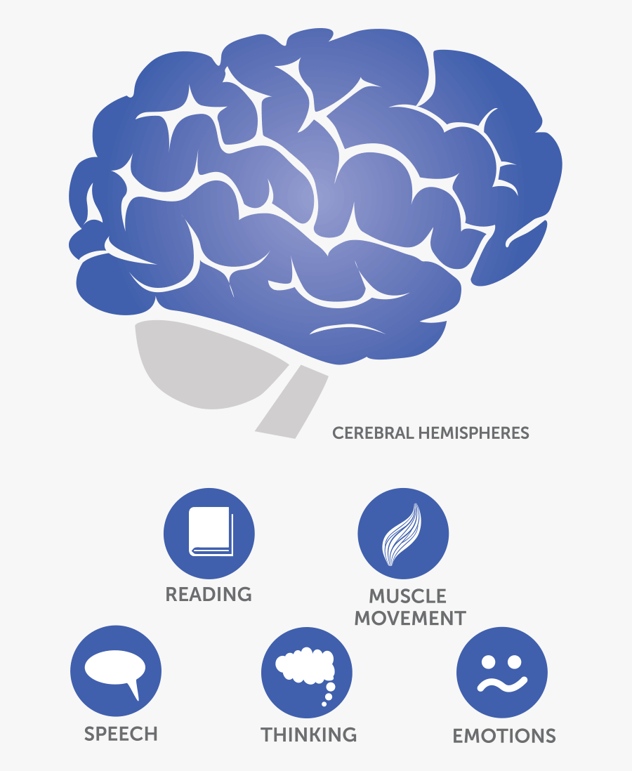 Where Does Glioblastoma Occur In The Brain - Glioblastoma Png, Transparent Clipart