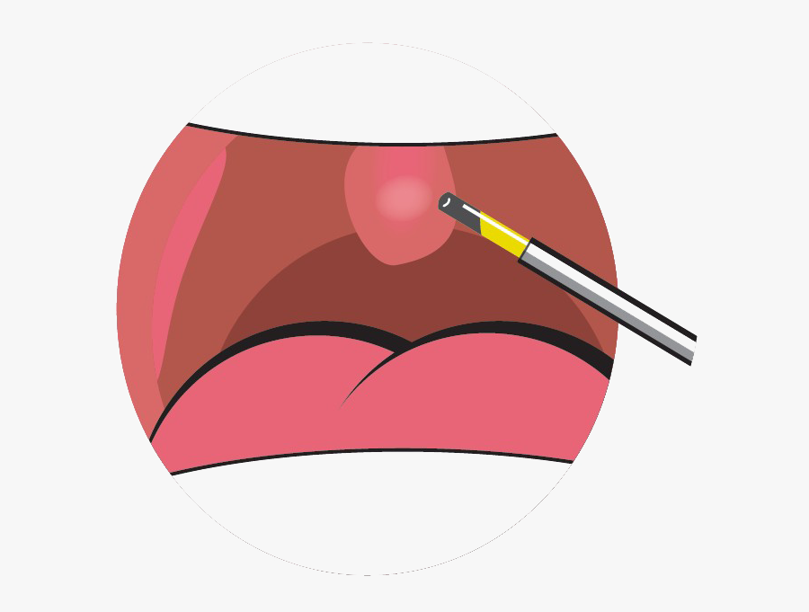 Clipart Mouth Tonsils, Transparent Clipart