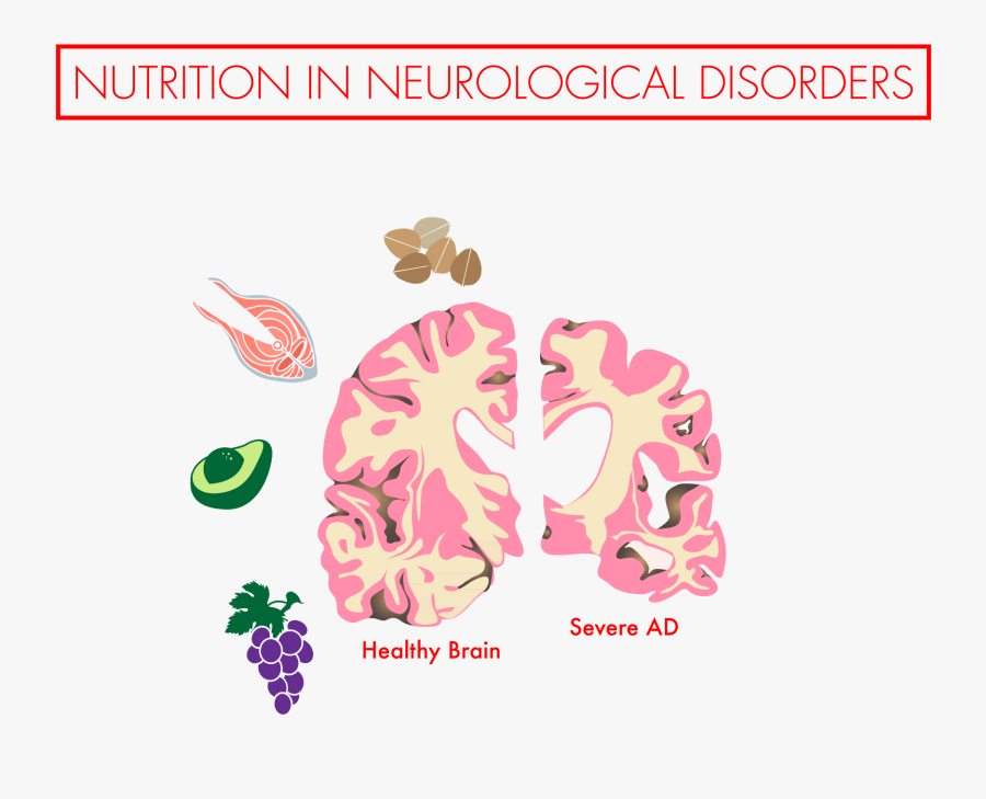 Alzheimer's Disease, Transparent Clipart