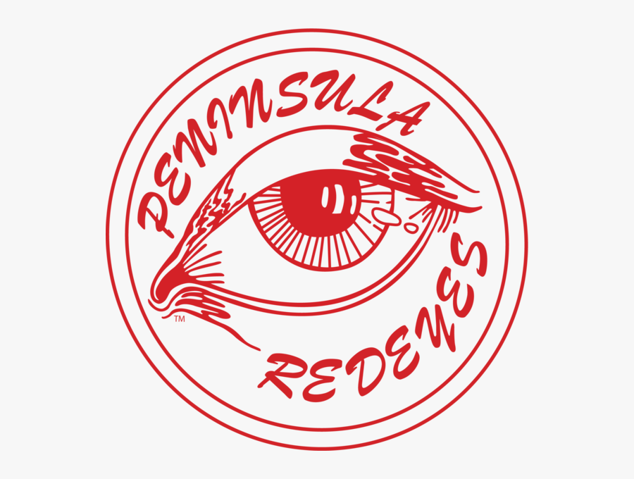 Peninsula Redeyes Round Vinyl Sticker"
 Class="lazyload - Circle, Transparent Clipart