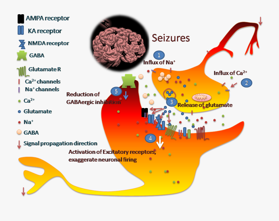 Generalized Seizures, Transparent Clipart