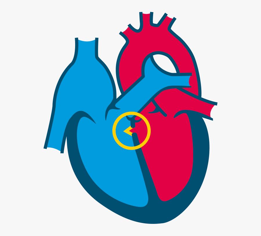 Congenital Heart Diseases Icon, Transparent Clipart