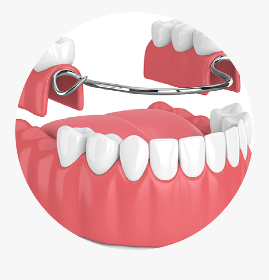 Dental Denture, Transparent Clipart