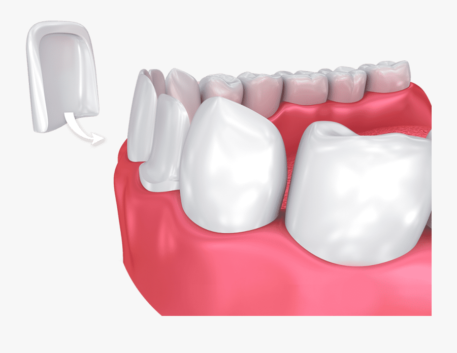 Dentures Clip Art, Transparent Clipart