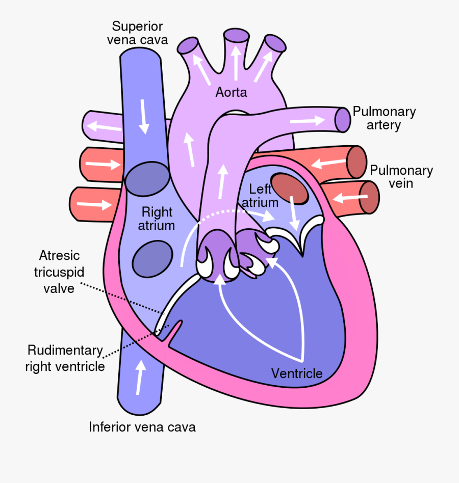 File - Tricuspid Atresia - Svg - Diagram Of The Heart - Human Heart Diagram, Transparent Clipart