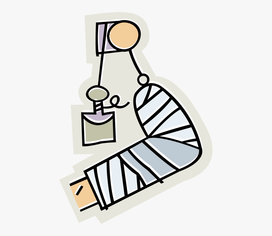 Vector Illustration Of Patient With Broken Leg In Traction - Broken Leg Clip Art, Transparent Clipart