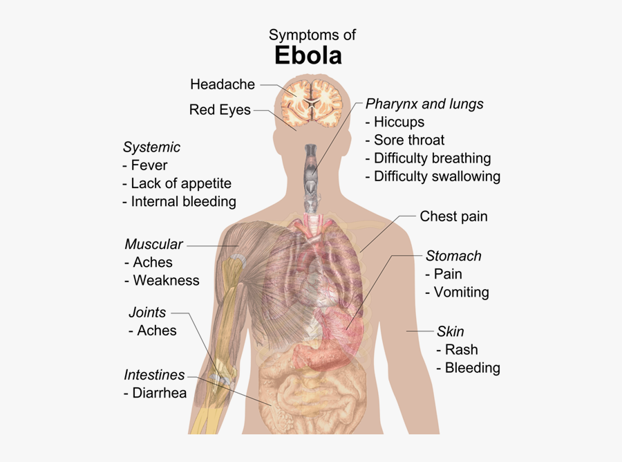 Ebola Symptoms - Happens If We Eat Slate Pencils, Transparent Clipart