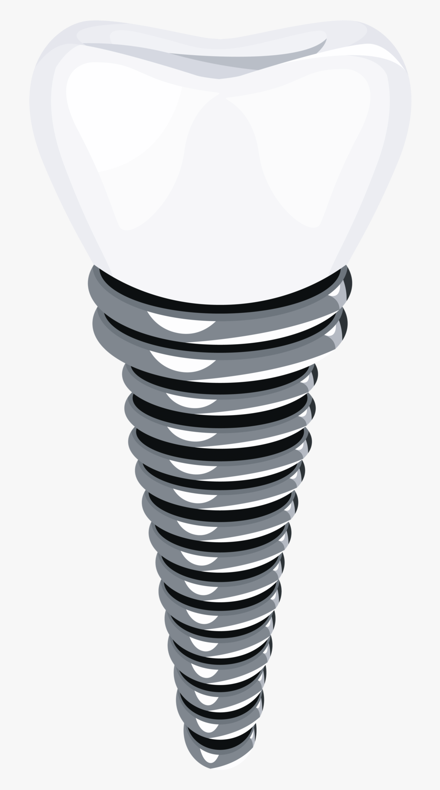Dental-implant - Implant Transparent, Transparent Clipart