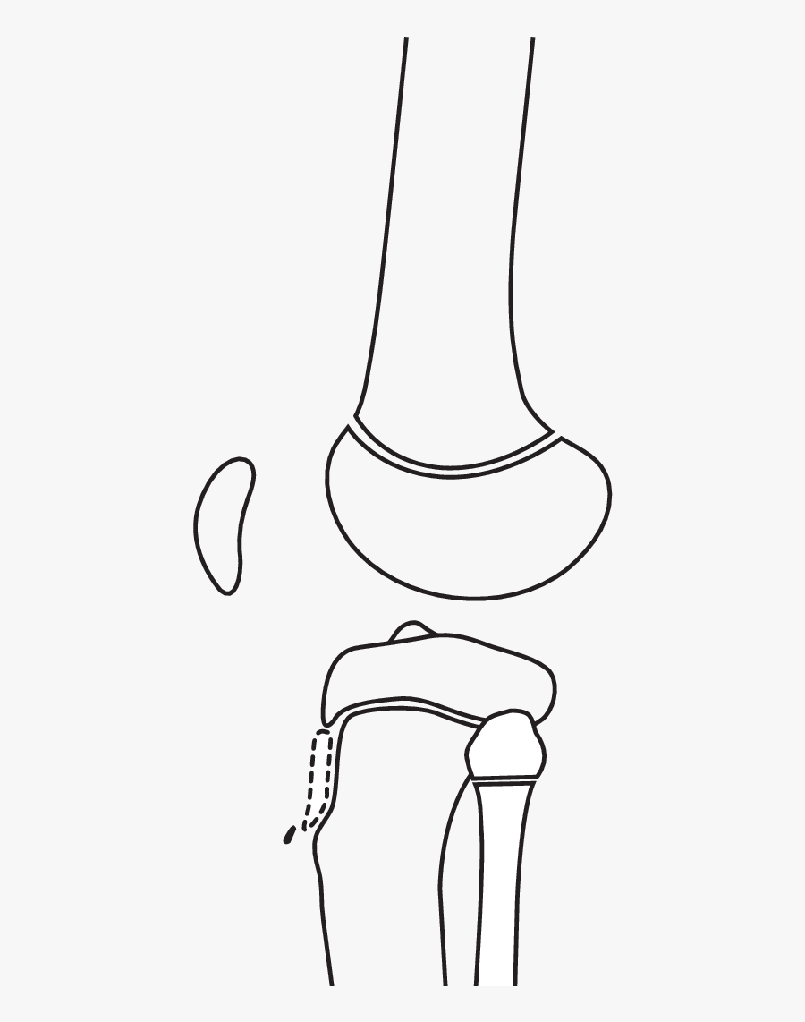 Schematic Diagram Demonstrating Our - Line Art, Transparent Clipart