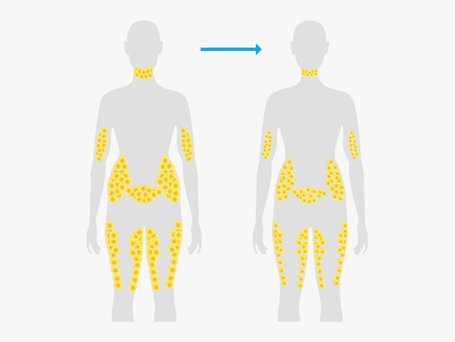 Fat Cell Location On Body, Transparent Clipart