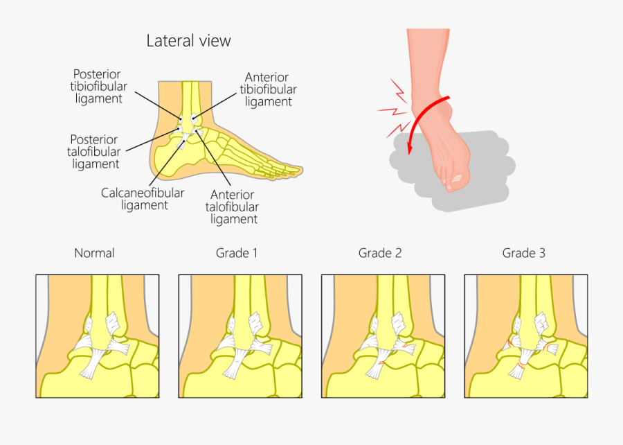 Washington Foot And Ankle - Illustration, Transparent Clipart