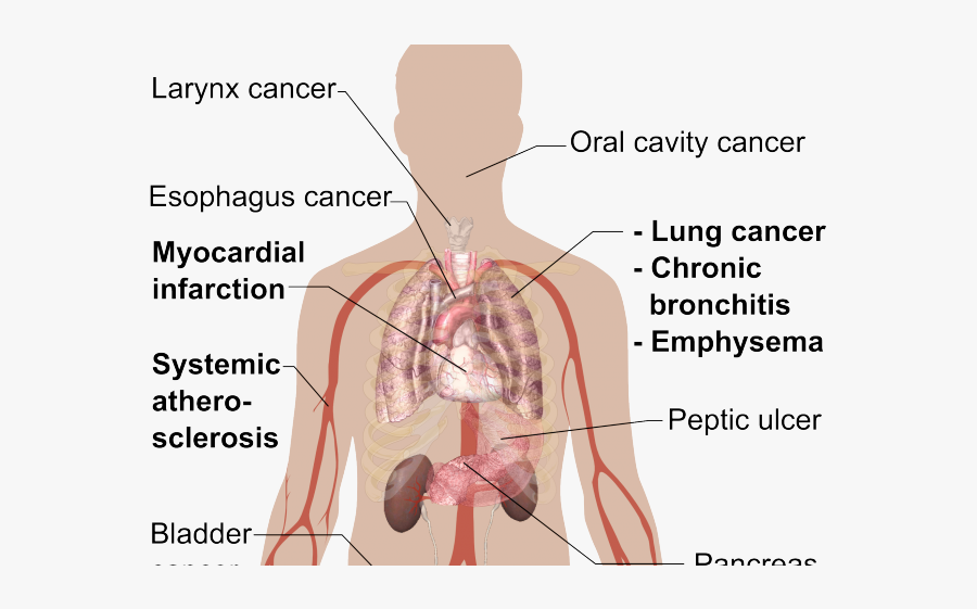Tobacco The Silent Killer, Transparent Clipart