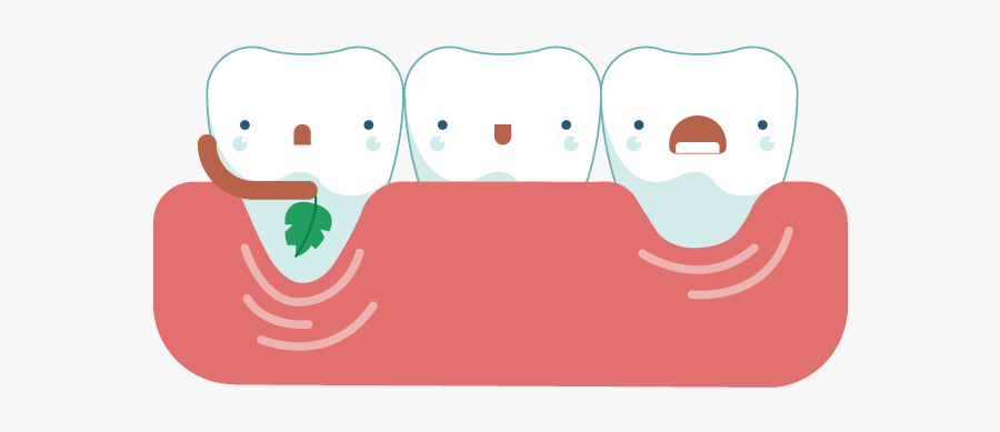 Receding Solutions Pinhole Surgical - Teeth Gums Png, Transparent Clipart