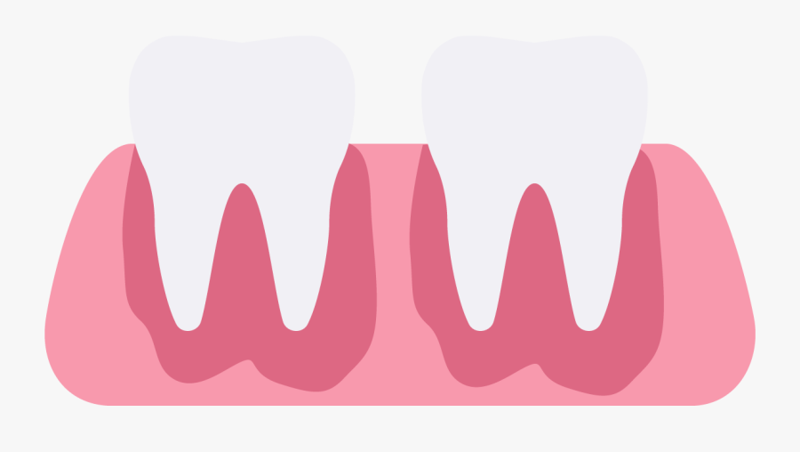 Gum Clipart Gum Disease, Transparent Clipart