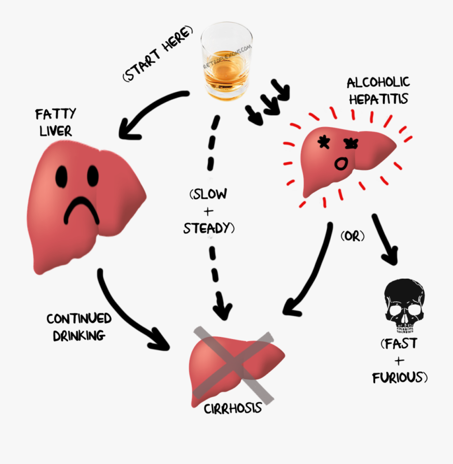 Poison Clipart Drank - Liver Of Drinking Alcohol, Transparent Clipart