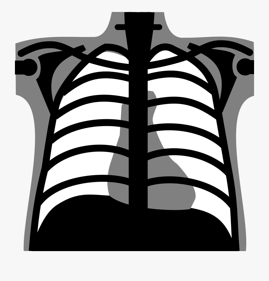 Transparent X Wing Clipart - Chest X Ray Vector, Transparent Clipart