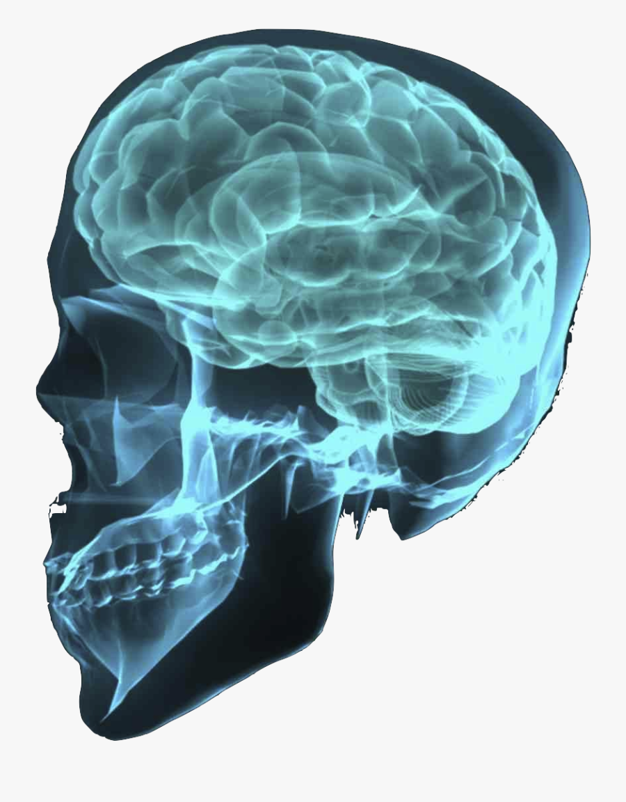 X Ray Png - Brain Xray Png, Transparent Clipart