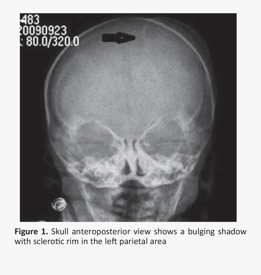 Clip Art Meandros Medical And Dental - Radiography, Transparent Clipart