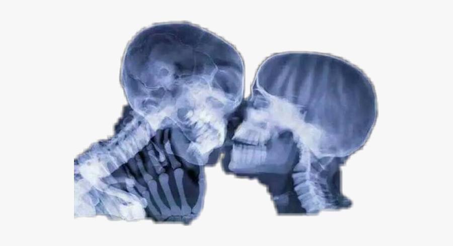 褲露 Freetoedit - X Ray Of People, Transparent Clipart