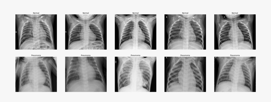 Clip Art Detecting With Deep Learning - Radiography, Transparent Clipart